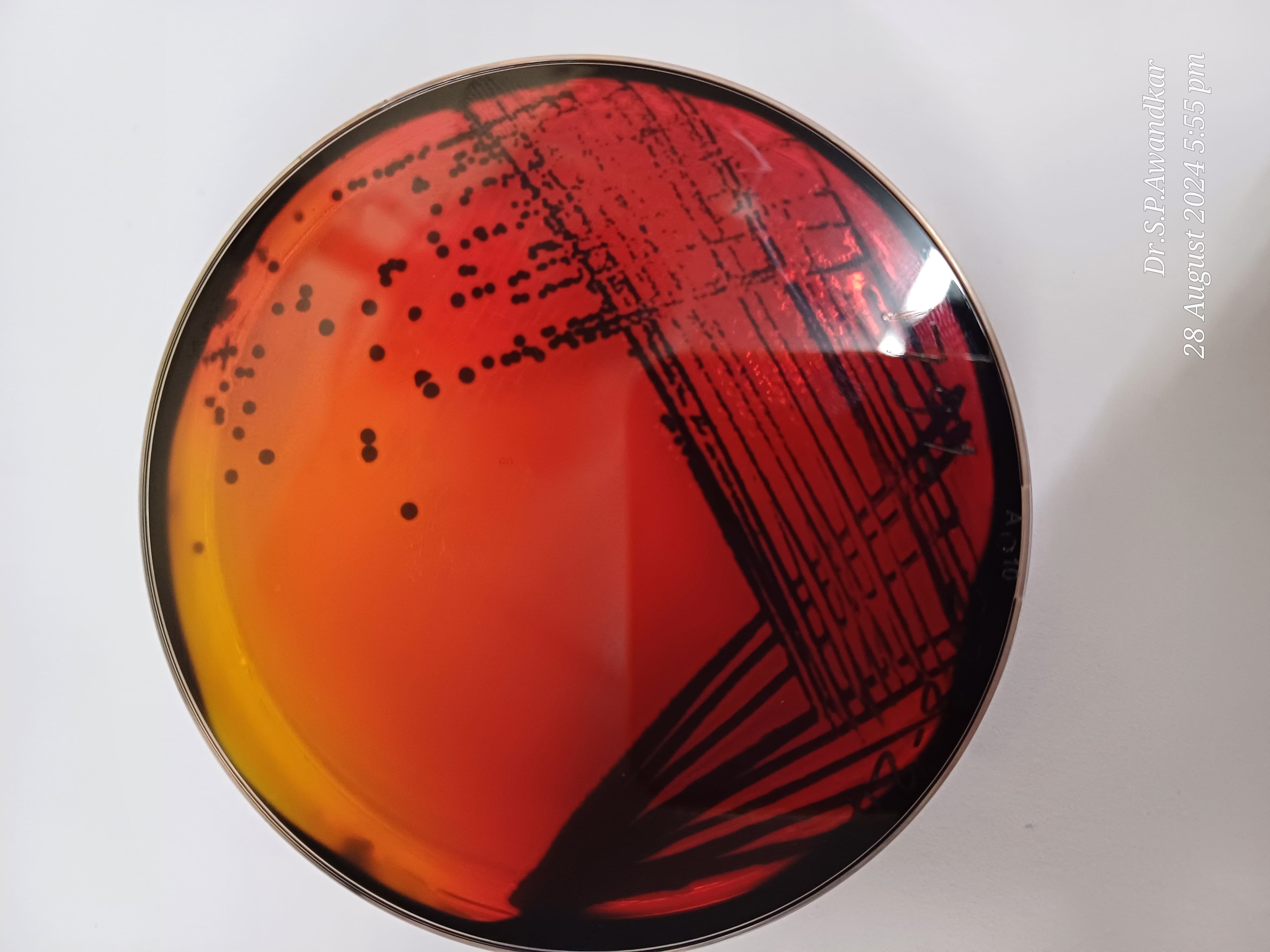 13. Salmonella Typhimurium